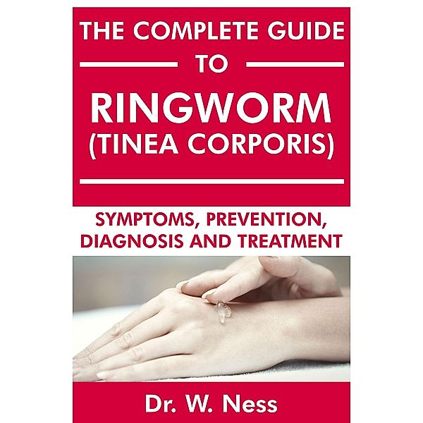 The Complete Guide to Ringworm (Tinea Corporis): Symptoms, Prevention, Diagnosis and Treatment, W. Ness