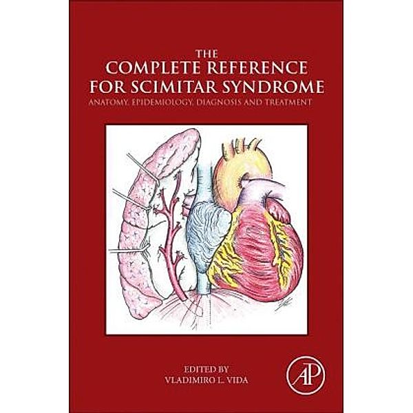The Complete Reference for Scimitar Syndrome