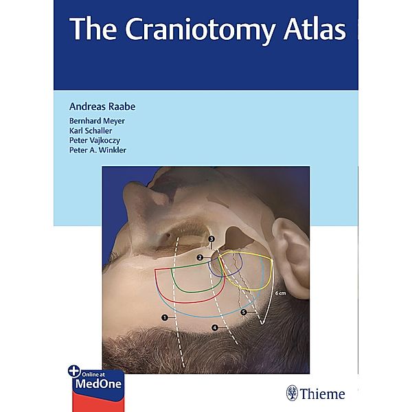 The Craniotomy Atlas