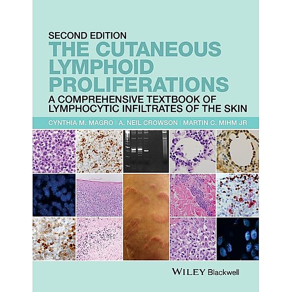 The Cutaneous Lymphoid Proliferations, Cynthia M. Magro, A. Neil Crowson, Martin C. Mihm