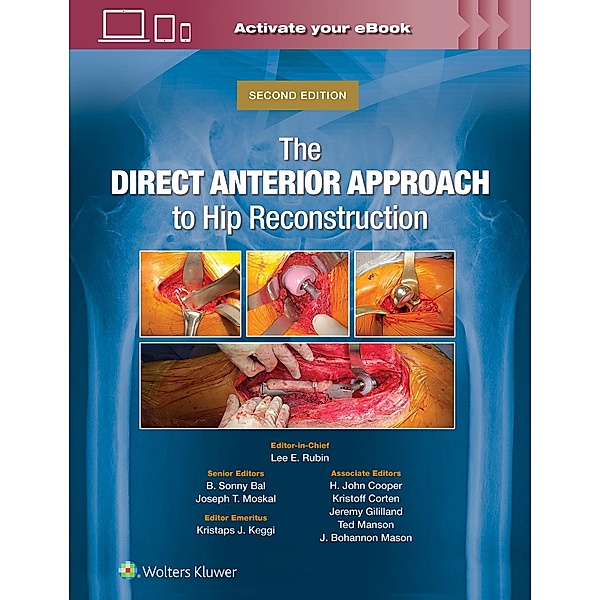 The Direct Anterior Approach to Hip Reconstruction, Lee E. Rubin, B. Sonny Bal, Joseph T. Moskal