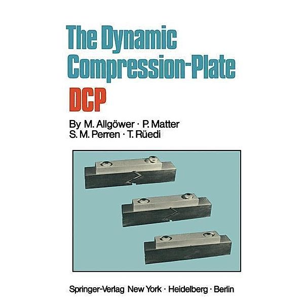 The Dynamic Compression Plate DCP, Martin Allgöwer, P. Matter, S. M. Perren, T. Rüedi