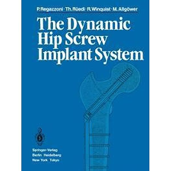 The Dynamic Hip Screw Implant System, P. Regazzoni, T. Rüedi, R. Winquist, M. Allgöwer