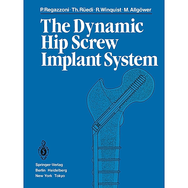 The Dynamic Hip Screw Implant System, P. Regazzoni, T. Rüedi, R. Winquist