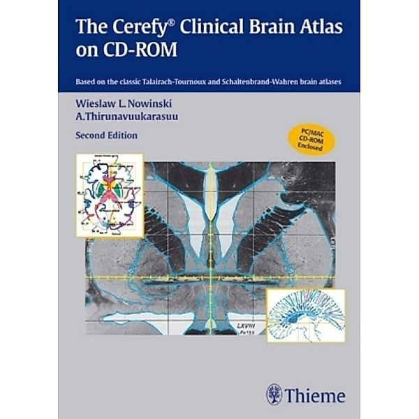 The Electronic Clinical Brain Atlas, 1 CD-ROM