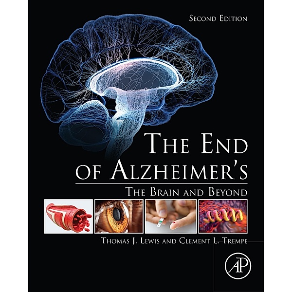 The End of Alzheimer's, Thomas J. Lewis, Clement L. Trempe