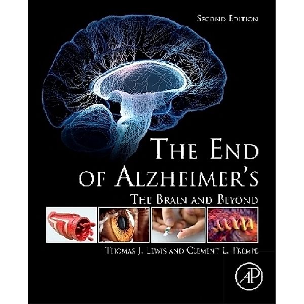 The End of Alzheimer's, Thomas J. Lewis, Clement L. Trempe