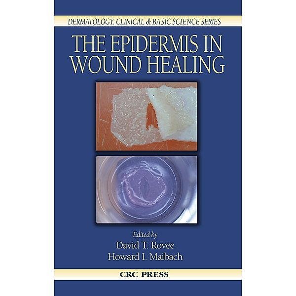 The Epidermis in Wound Healing