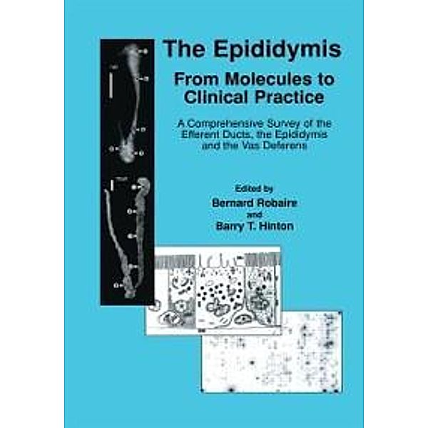 The Epididymis: From Molecules to Clinical Practice