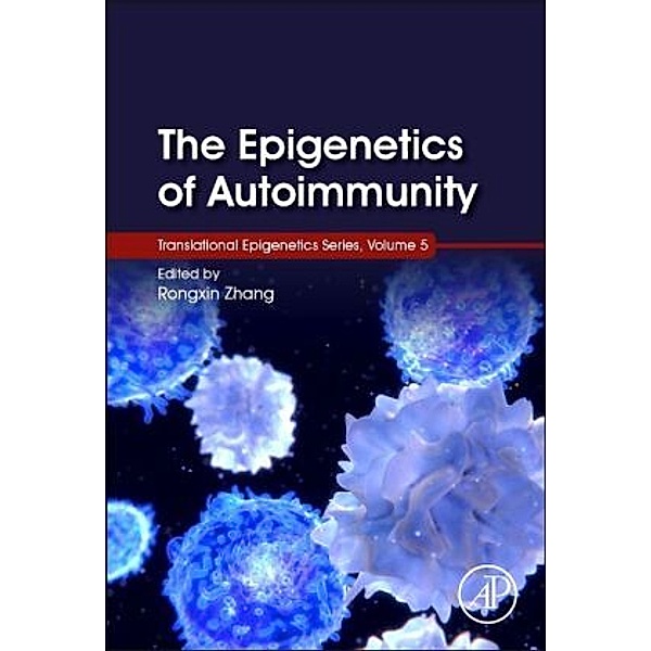 The Epigenetics of Autoimmunity