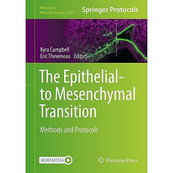 The Epithelial-to Mesenchymal Transition / Methods in Molecular Biology Bd.2179