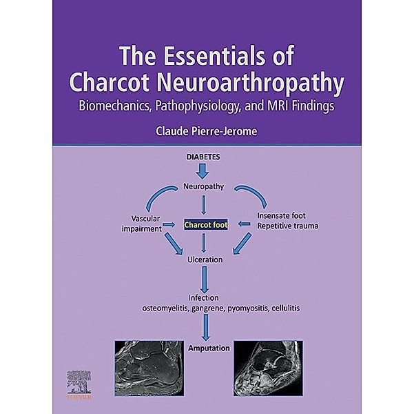 The Essentials of Charcot Neuroarthropathy, Claude Pierre-Jerome