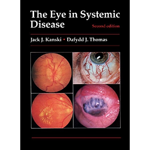 The Eye in Systemic Disease, Jack J. Kanski, Dafydd J. Thomas