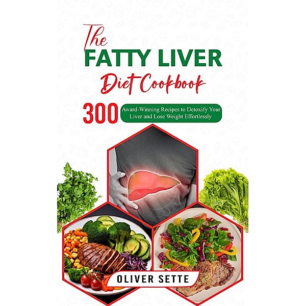 The Fatty Liver Diet Cookbook: 300 Award-Winning Recipes to Detoxify Your Liver and Lose Weight Effortlessly, Oliver Sette