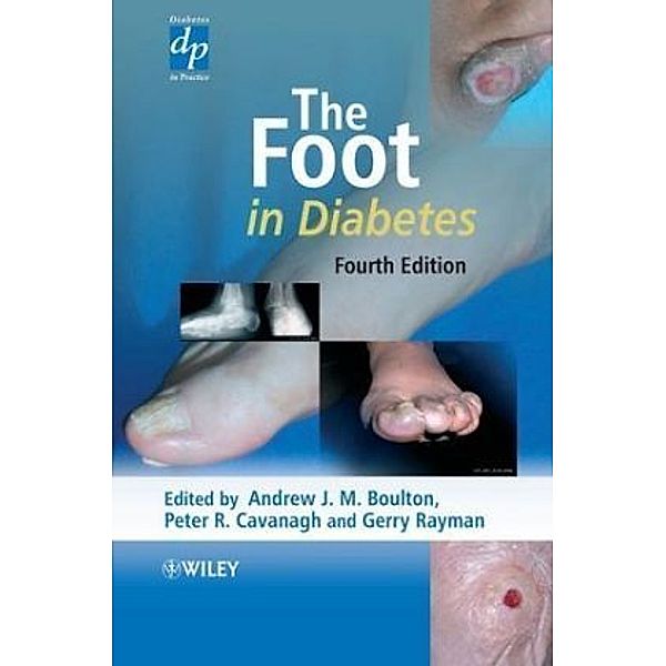 The Foot in Diabetes