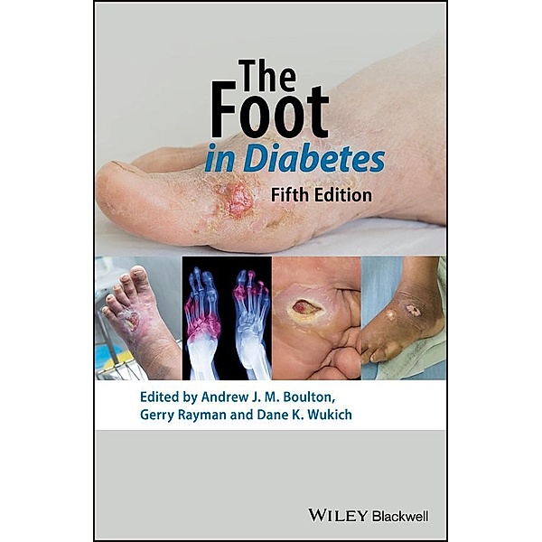 The Foot in Diabetes / Wiley Diabetes in Practice Series, Andrew J. M. Boulton
