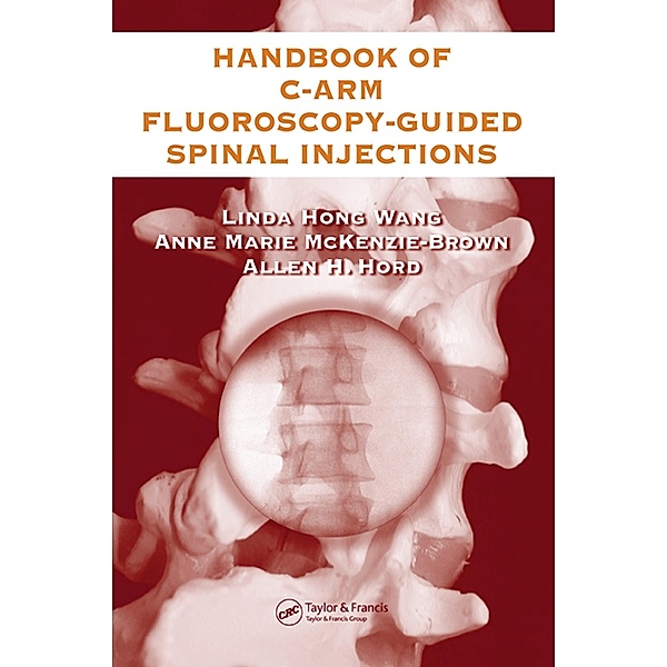 The Handbook of C-Arm Fluoroscopy-Guided Spinal Injections, Linda Hong Wang, Anne Marie McKenzie-Brown, Allen Hord