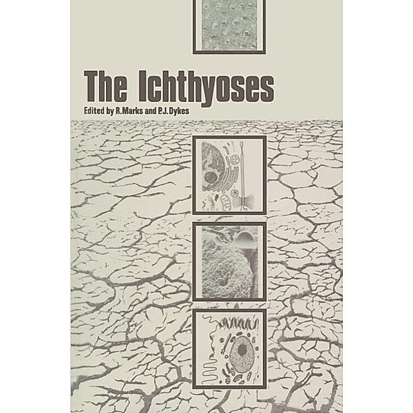 The Ichthyoses