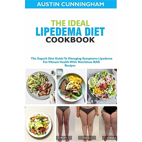 The Ideal Lipedema Diet Cookbook; The Superb Diet Guide To Managing Symptoms Lipedema For Vibrant Health With Nutritious RAD Recipes, Austin Cunningham