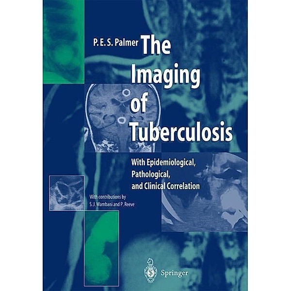 The Imaging of Tuberculosis, P.E.S. Palmer