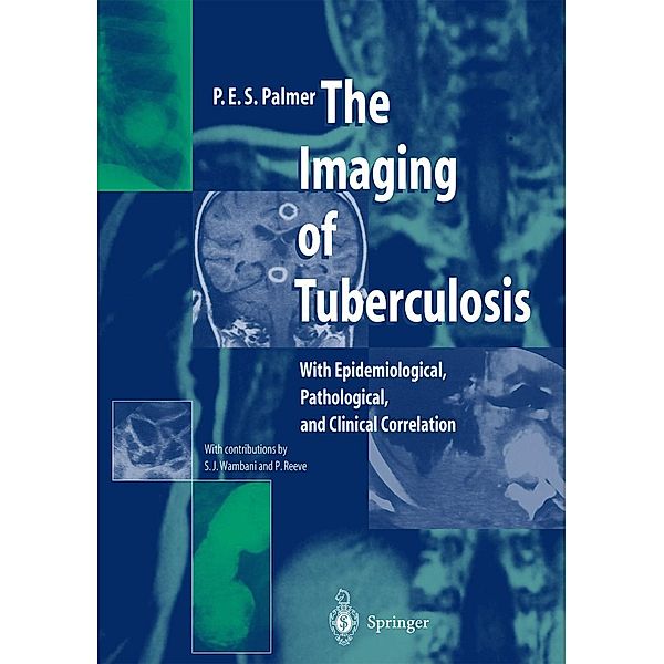 The Imaging of Tuberculosis, P. E. S. Palmer