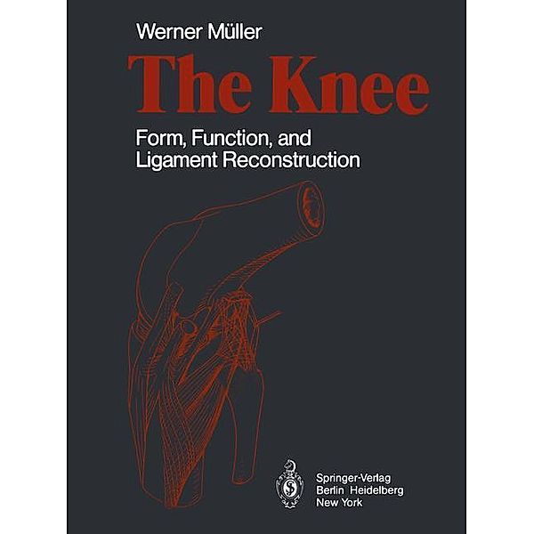 The Knee, W. Müller