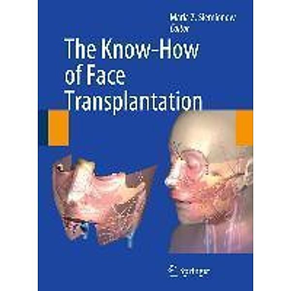 The Know-How of Face Transplantation