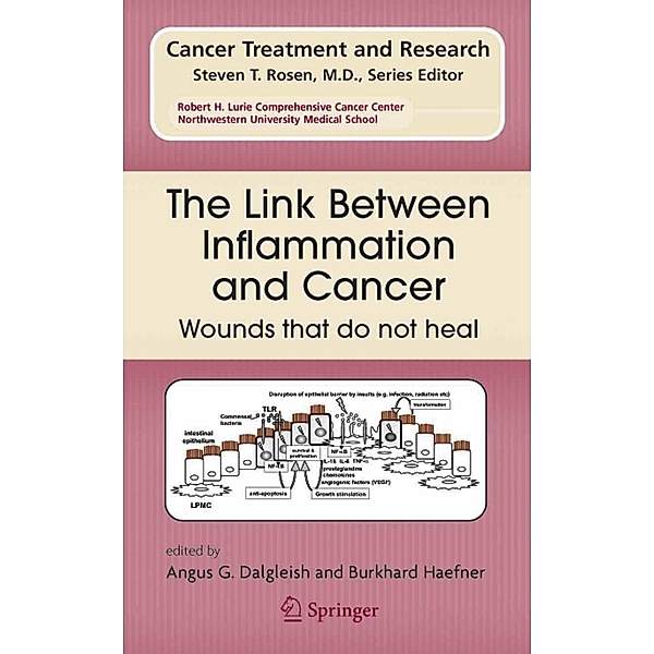 The Link Between Inflammation and Cancer / Cancer Treatment and Research Bd.130
