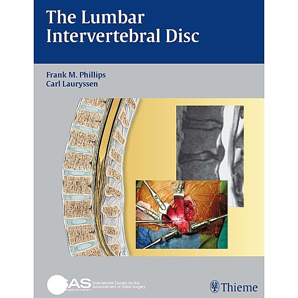 The Lumbar Intervertebral Disc