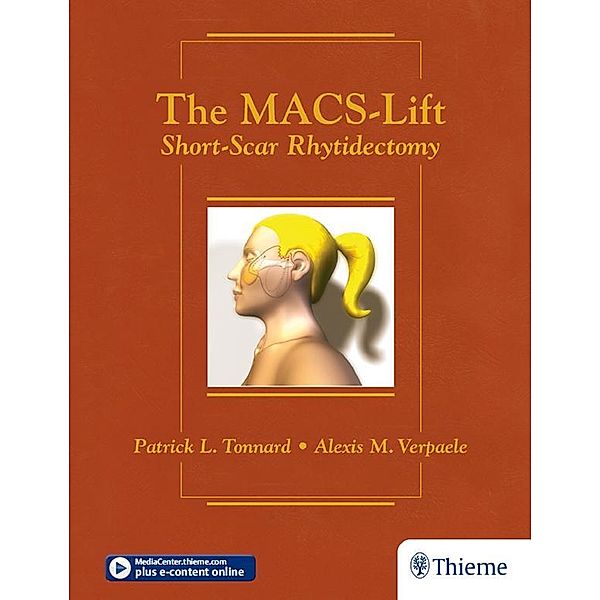 The MACS-Lift, Patrick Tonnard, Alexis Verpaele