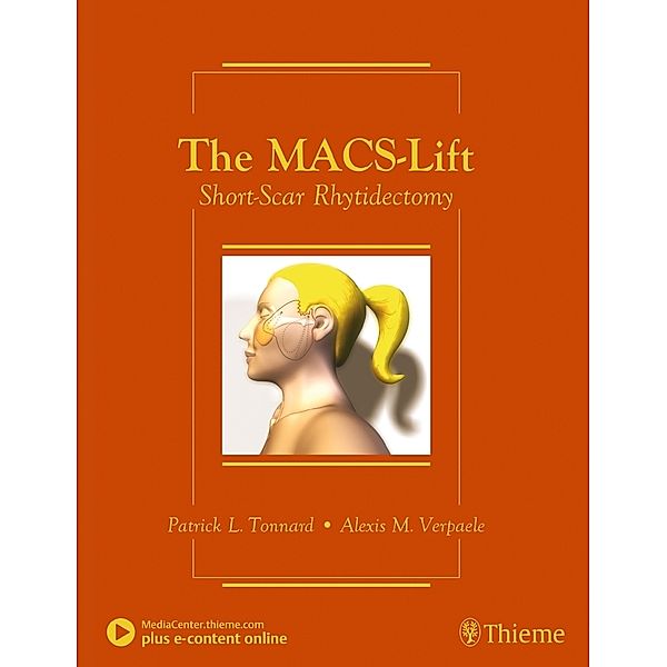 The MACS-Lift, Patrick Tonnard, Alexis Verpaele