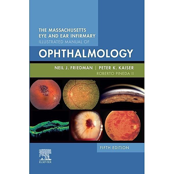 The Massachusetts Eye and Ear Infirmary Illustrated Manual of Ophthalmology E-Book, Neil J. Friedman, Peter K. Kaiser, II Roberto Pineda