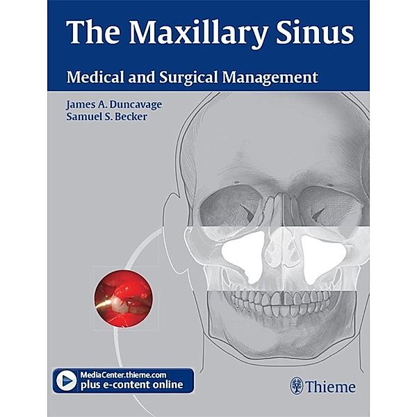 The Maxillary Sinus