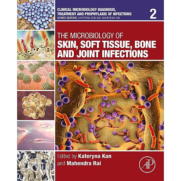 The Microbiology of Skin, Soft Tissue, Bone and Joint Infections