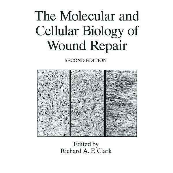 The Molecular and Cellular Biology of Wound Repair