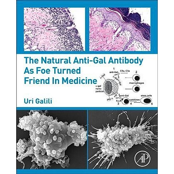 The Natural Anti-Gal Antibody as Foe Turned Friend in Medicine, Uri Galili