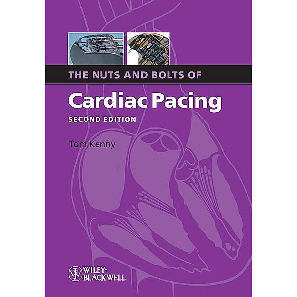 The Nuts and Bolts of Cardiac Pacing / Nuts and Bolts Series (Replaced by 5113), Tom Kenny