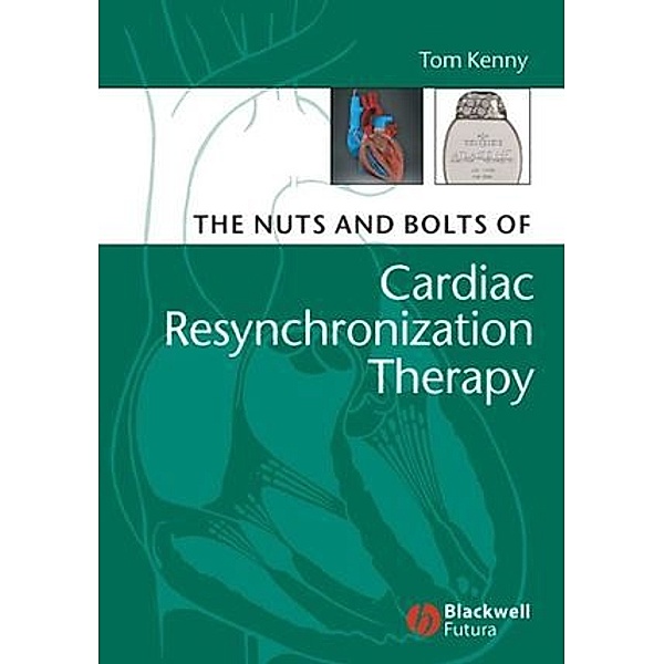 The Nuts and Bolts of Cardiac Resynchronization Therapy, Tom Kenny