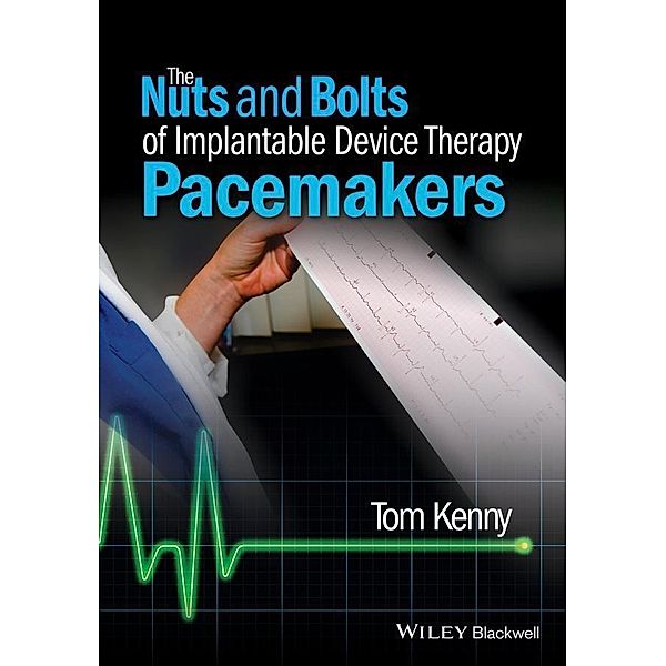 The Nuts and Bolts of Implantable Device Therapy / The Nuts and Bolts Series, Tom Kenny