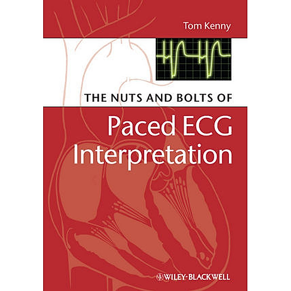 The Nuts and Bolts of Interpreting Paced ECGs and EGMs, Tom Kenny