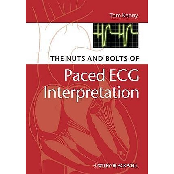 The Nuts and bolts of Paced ECG Interpretation, Tom Kenny