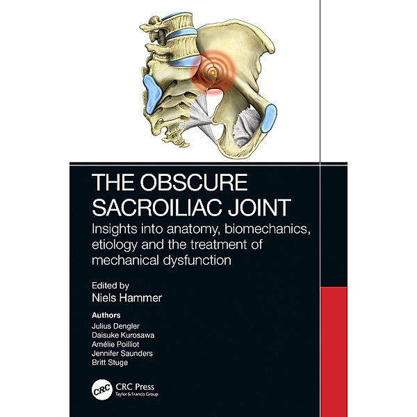 The Obscure Sacroiliac Joint
