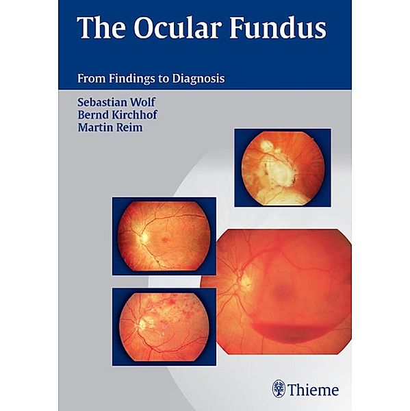 The Ocular Fundus, Sebastian Wolf, Martin Reim, Bernd Kirchhof