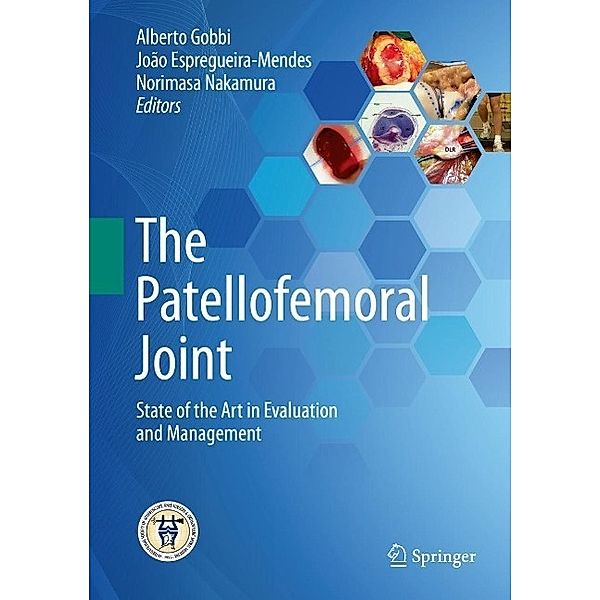 The Patellofemoral Joint