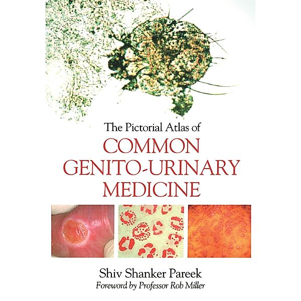 The Pictorial Atlas of Common Genito-Urinary Medicine, Shiva Pareek