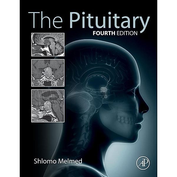 The Pituitary