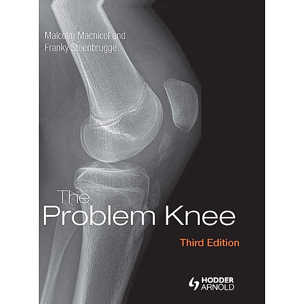 The Problem Knee, Malcolm Macnicol, Franky Steenbrugge
