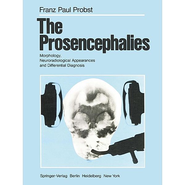 The Prosencephalies, F. P. Probst