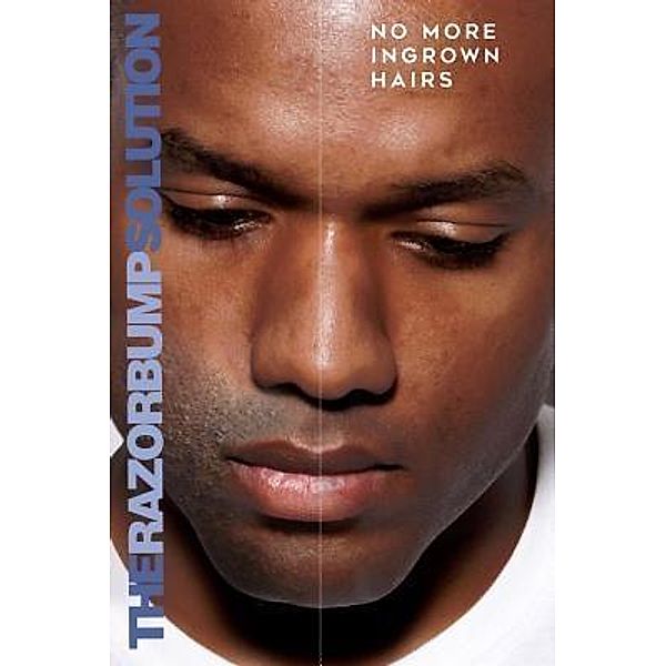 THE RAZOR BUMP SOLUTION; NO MORE INGROWN HAIRS / William Washington, Al Washington