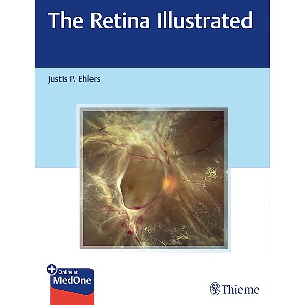 The Retina Illustrated, Justis P. Ehlers